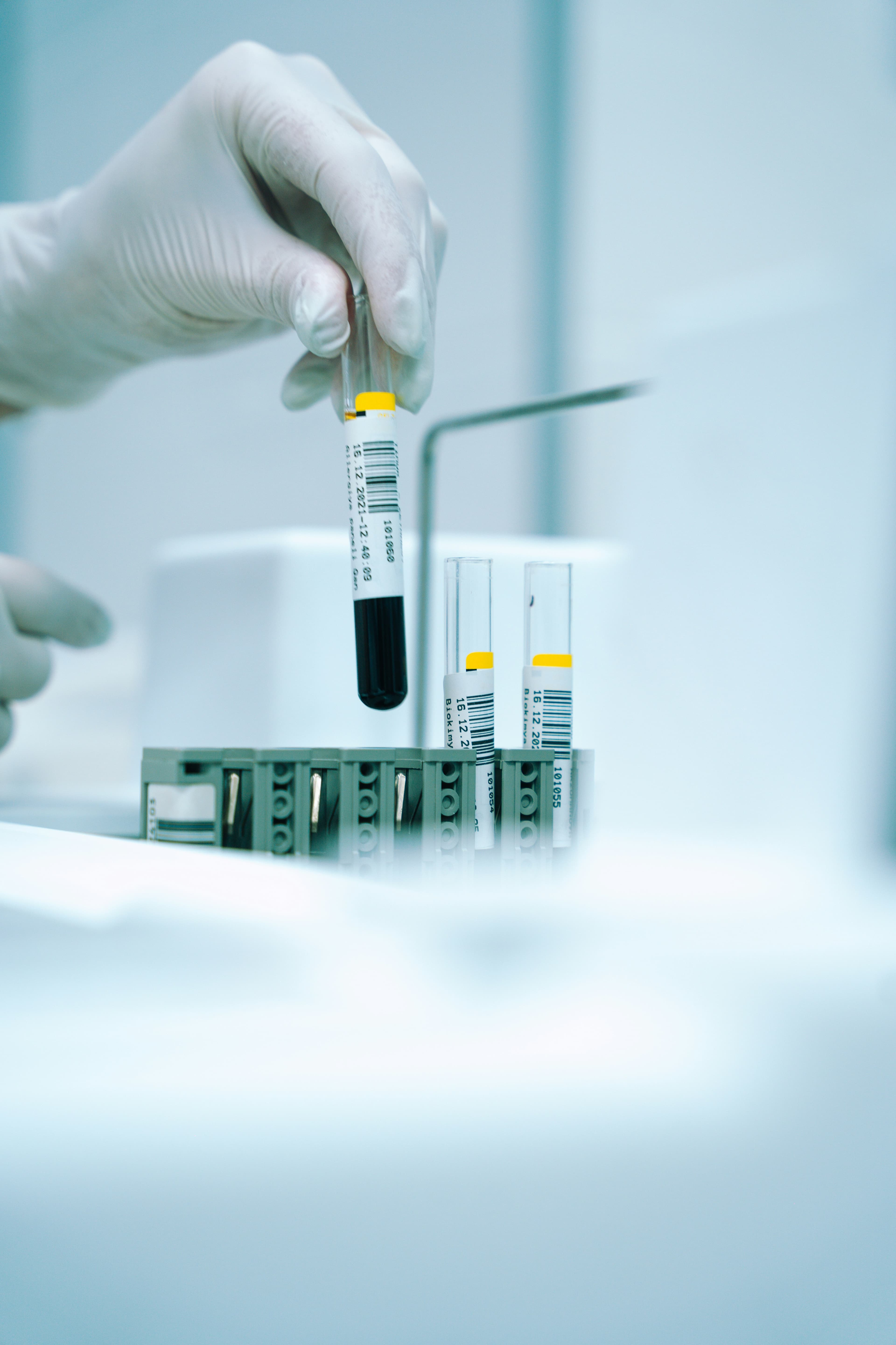 A gloved hand holding a test tube filled with liquid
